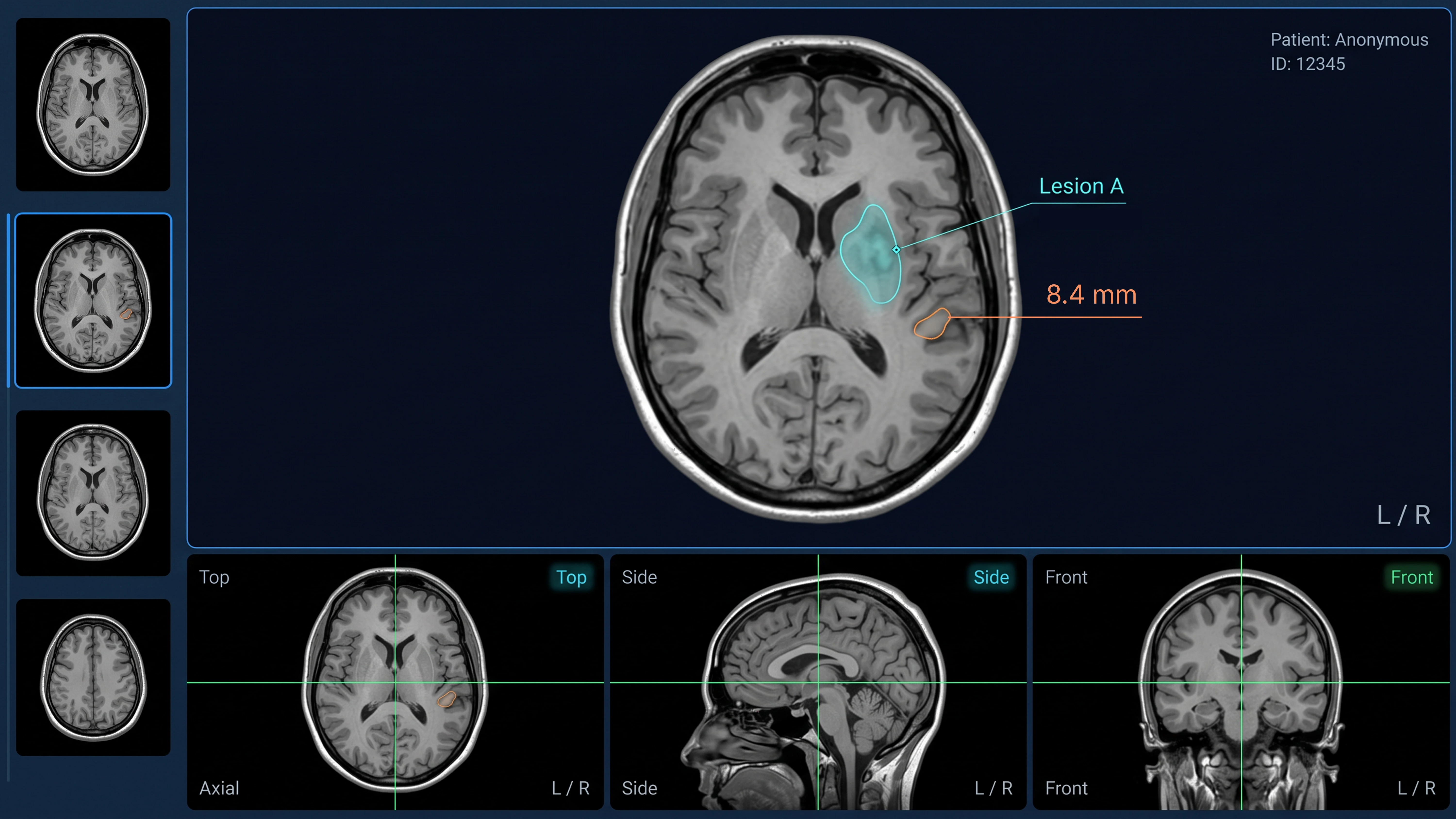 LabelFort DICOM brain MRI annotation with multi-plane review